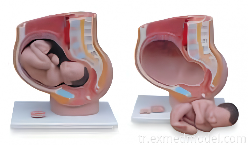 Fetuslu dişi pelvis Female Pelvis with Fetus